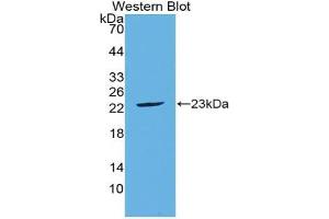 Western blot analysis of the recombinant protein. (FGF21 Antikörper  (AA 29-209))