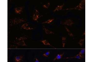 Immunofluorescence analysis of C6 cells using TGFB1 Polyclonal Antibody at dilution of 1:100. (TGFB1 Antikörper)