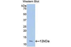 Western Blotting (WB) image for anti-Chemokine (C-C Motif) Ligand 24 (CCL24) (AA 27-119) antibody (ABIN1078373) (CCL24 Antikörper  (AA 27-119))