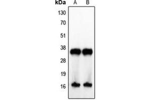 Western blot analysis of IL-4 expression in Jurkat (A), human tonsil (B) whole cell lysates. (IL-4 Antikörper  (Center))