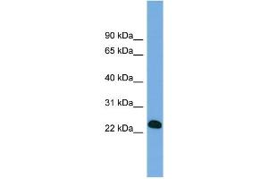 WB Suggested Anti-BCL7A Antibody Titration: 0.