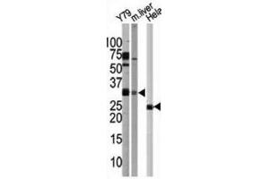 Western Blotting (WB) image for anti-ATG5 Autophagy Related 5 (ATG5) antibody (ABIN2999976) (ATG5 Antikörper)
