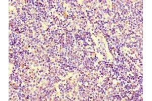Immunohistochemistry of paraffin-embedded human lymph node tissue using ABIN7156118 at dilution of 1:100