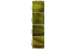 Immunofluorescence (Paraffin-embedded Sections) (IF (p)) image for anti-SRY (Sex Determining Region Y)-Box 2 (SOX2) antibody (ABIN2855074)