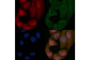 p53 Mouse Monoclonal Antibody staining Hela cells by IF/ICC.