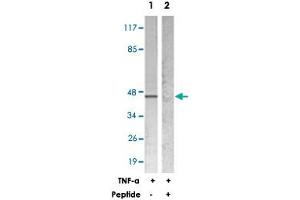 Western blot analysis of extracts from HeLa cells treated with TNF-a (20 ng/mL 5 min), using NFKBIE polyclonal antibody . (NFKBIE Antikörper)