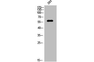 Western Blot analysis of 293 cells using Phospho-PAKγ (S20) Polyclonal Antibody (PAK2 Antikörper  (pSer20))