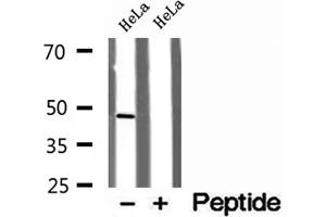Western blot analysis of extracts of HeLa cells, using RNH1 antibody. (RNH1 Antikörper  (Internal Region))