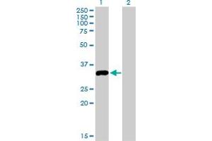 Western Blot analysis of STK16 expression in transfected 293T cell line by STK16 monoclonal antibody (M03), clone 2G6. (STK16 Antikörper  (AA 1-100))