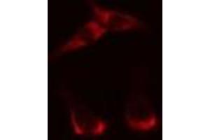 ABIN6269295 staining HepG2? (14-3-3 zeta Antikörper  (Internal Region))