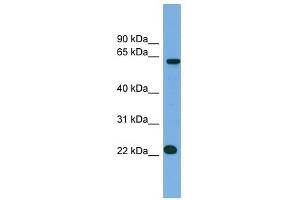 C21ORF45 antibody used at 1 ug/ml to detect target protein. (C21ORF45 Antikörper  (N-Term))