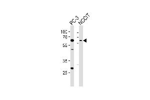 Western blot analysis of lysates from PC-3, NCCIT cell line (from left to right), using TBX22 Antibody (C-term) (ABIN6243313 and ABIN6577614). (T-Box 22 Antikörper  (C-Term))