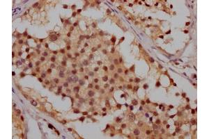 IHC image of ABIN7127351 diluted at 1:100 and staining in paraffin-embedded human testis tissue performed on a Leica BondTM system. (Rekombinanter ATM Antikörper)