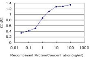 Detection limit for recombinant GST tagged PALM is approximately 0. (Paralemmin Antikörper  (AA 176-284))