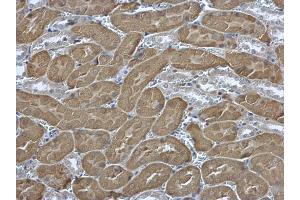 Immunohistochemistry (IHC) image for anti-Eukaryotic Translation Initiation Factor 2, Subunit 2 Beta, 38kDa (EIF2S2) antibody (ABIN2856393)