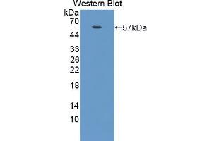 Western blot analysis of the recombinant protein. (NUAK1 Antikörper  (AA 404-651))