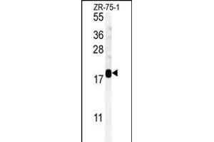 SDHAF1 Antibody (Center) (ABIN651585 and ABIN2840312) western blot analysis in ZR-75-1 cell line lysates (35 μg/lane). (SDHAF1 Antikörper  (AA 34-62))