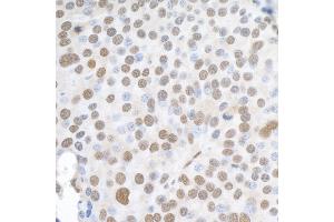 anti-Heterogeneous Nuclear Ribonucleoprotein K (HNRNPK) (C-Term) antibody