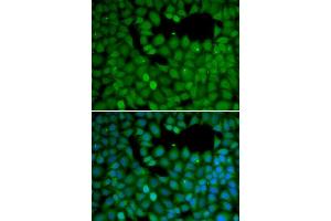 Immunofluorescence (IF) image for anti-Neuroepithelial Cell Transforming 1 (NET1) (AA 1-300) antibody (ABIN1513253) (NET1 Antikörper  (AA 1-300))