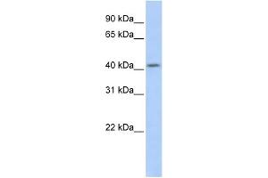 WB Suggested Anti-SOHLH1 Antibody Titration:  0. (SOHLH1 Antikörper  (Middle Region))