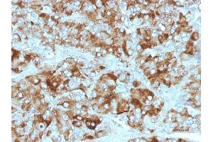 Formalin-fixed, paraffin-embedded Adrenal Gland stained with Chromogranin A Monoclonal Antibody (CGA/413+ CHGA/777+ CHGA/798) (Chromogranin A Antikörper)