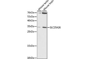 Western blot analysis of extracts of various cell lines, using SLC25 antibody (ABIN7270437) at 1:1000 dilution. (SLC25A26 Antikörper  (AA 105-185))