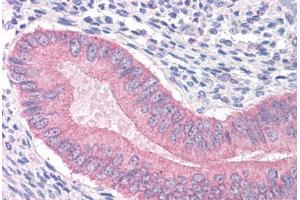 Human Uterus: Formalin-Fixed, Paraffin-Embedded (FFPE) (CTNNA1 Antikörper  (AA 871-883))