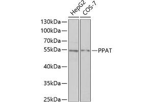 Western blot analysis of extracts of various cell lines, using PPAT antibody (ABIN6128488, ABIN6146009, ABIN6146010 and ABIN6222409) at 1:1000 dilution. (PPAT Antikörper  (AA 1-280))