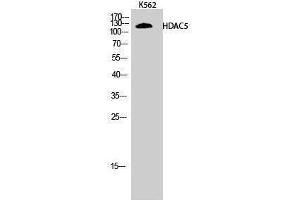Western Blotting (WB) image for anti-Histone Deacetylase 5 (HDAC5) (Tyr512) antibody (ABIN3184988) (HDAC5 Antikörper  (Tyr512))
