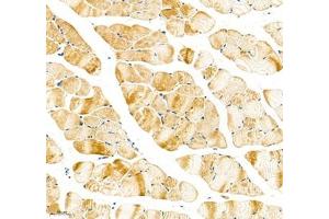 Immunohistochemistry of paraffin embedded mouse skeletal muscle using Sarcomeric α Actinin (ABIN7075510) at dilution of 1:1000 (200x lens) (Sarcomeric alpha Actinin Antikörper)