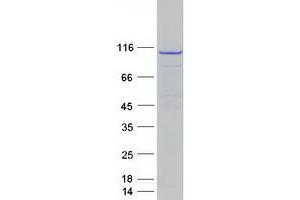 ERCC4 Protein (Myc-DYKDDDDK Tag)