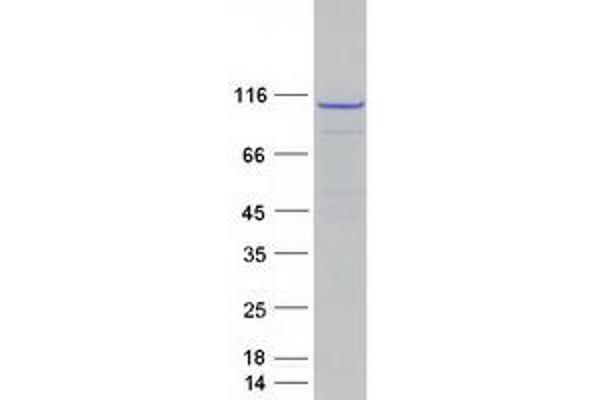 ERCC4 Protein (Myc-DYKDDDDK Tag)