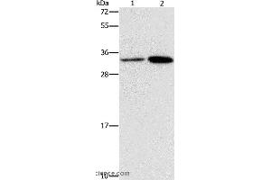 Western blot analysis of Hela and A431 cell, using CDC34 Polyclonal Antibody at dilution of 1:900 (CDC34 Antikörper)