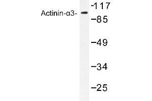 Image no. 1 for anti-Actinin, alpha 3 (ACTN3) antibody (ABIN272284) (ACTN3 Antikörper)