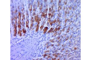 Immunohistochemistry (Paraffin-embedded Sections) (IHC (p)) image for anti-Transforming Growth Factor, alpha (TGFA) (AA 40-89) antibody (ABIN724415)