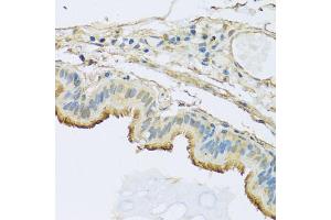 Immunohistochemistry of paraffin-embedded human trachea using NDUFB5 antibody. (NDUFB5 Antikörper)