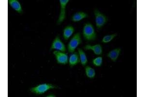 Detection of MAOA in Human HepG2 cell using Polyclonal Antibody to Monoamine Oxidase A (MAOA) (Monoamine Oxidase A Antikörper  (AA 229-428))