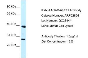 Western Blotting (WB) image for anti-Melanoma Antigen Family F, 1 (MAGEF1) (N-Term) antibody (ABIN2789273) (MAGEF1 Antikörper  (N-Term))