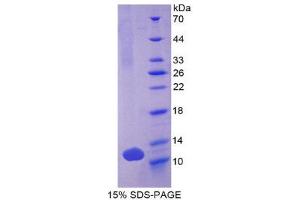 SDS-PAGE (SDS) image for Defensin, beta 103A (DEFB103A) (AA 23-67) protein (His tag) (ABIN1879825)