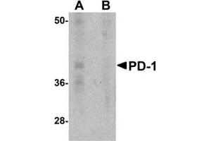 Western Blotting (WB) image for anti-Programmed Cell Death 1 (PDCD1) antibody (ABIN1031789) (PD-1 Antikörper)