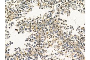 VAPA Mouse Monoclonal Antibody at 1/100 staining mouse testis tissue by IHC-P. (VAPA Antikörper)