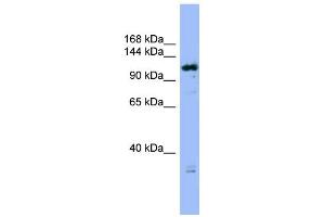 WB Suggested Anti-FAM29A Antibody Titration: 0.