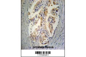 STC2 Antibody immunohistochemistry analysis in formalin fixed and paraffin embedded human prostate tissue followed by peroxidase conjugation of the secondary antibody and DAB staining. (Stanniocalcin 2 Antikörper  (C-Term))