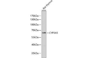 Western blot analysis of extracts of Rat thymus, using CYP3 antibody (ABIN6130166, ABIN6139354, ABIN6139355 and ABIN6223584) at 1:1000 dilution.