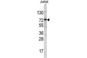 Western blot analysis of NKRF antibody (Center) in Jurkat cell line lysates (35ug/lane). (NKRF Antikörper  (Middle Region))