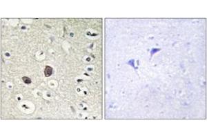 Immunohistochemistry analysis of paraffin-embedded human brain tissue, using TIE2 (Ab-1102) Antibody. (TEK Antikörper  (AA 1068-1117))
