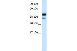 WB Suggested Anti-CTBP1 Antibody Titration:  0. (CTBP1 Antikörper  (C-Term))