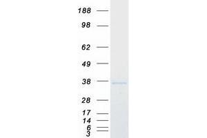 Western Blotting (WB) image for Gem (Nuclear Organelle) Associated Protein 2 (GEMIN2) protein (Myc-DYKDDDDK Tag) (ABIN2732069)