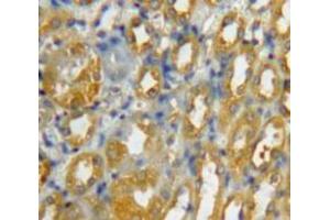 Used in DAB staining on fromalin fixed paraffin-embedded Kidney tissue (CCL8 Antikörper  (AA 1-99))