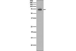 Western blot analysis of IAP2 expression in Ramos cell lysate.